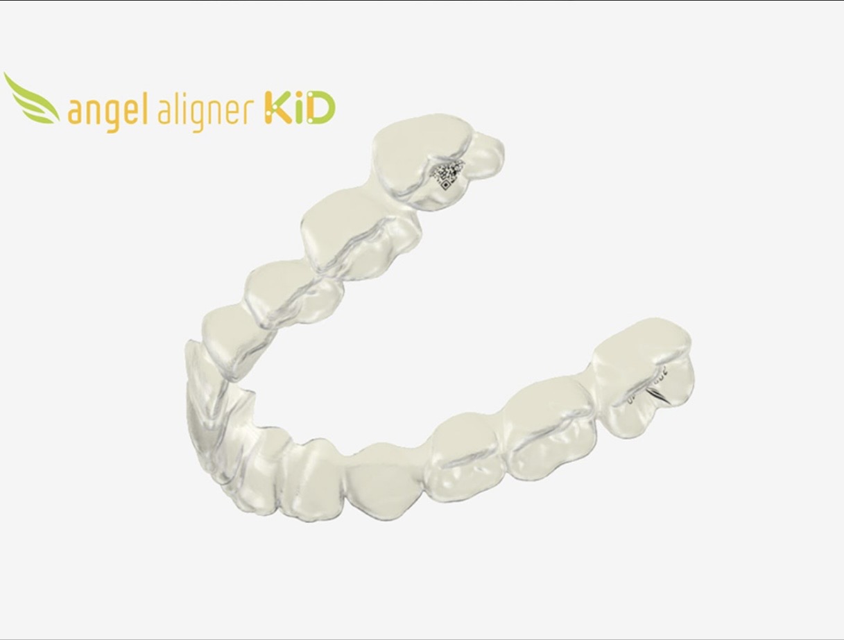 エンジェルアライナーKiD（子どものマウスピース矯正）