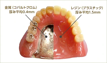 金属とレジンの入れ歯の説明画像