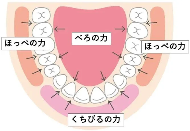 MFT（口腔筋機能療法）